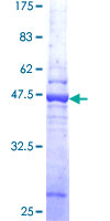 AP3S1 Protein - 12.5% SDS-PAGE of human AP3S1 stained with Coomassie Blue