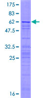 AP3S2 Protein - 12.5% SDS-PAGE of human AP3S2 stained with Coomassie Blue