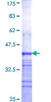 AP3S2 Protein - 12.5% SDS-PAGE Stained with Coomassie Blue.