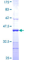 AP4B1 Protein - 12.5% SDS-PAGE Stained with Coomassie Blue.