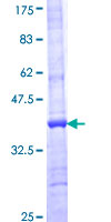 AP4E1 / Adaptin Epsilon Protein - 12.5% SDS-PAGE Stained with Coomassie Blue.