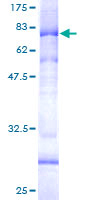 AP4M1 Protein - 12.5% SDS-PAGE of human AP4M1 stained with Coomassie Blue