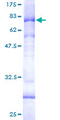 AP4M1 Protein - 12.5% SDS-PAGE of human AP4M1 stained with Coomassie Blue