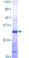 AP4M1 Protein - 12.5% SDS-PAGE Stained with Coomassie Blue.
