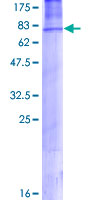 AP50 / AP2M1 Protein - 12.5% SDS-PAGE of human AP2M1 stained with Coomassie Blue
