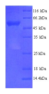 AP50 / AP2M1 Protein