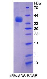 AP50 / AP2M1 Protein - Recombinant Adaptor Related Protein Complex 2 Mu 1 By SDS-PAGE