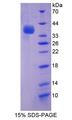 AP50 / AP2M1 Protein - Recombinant Adaptor Related Protein Complex 2 Mu 1 By SDS-PAGE