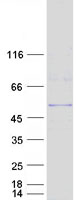 AP50 / AP2M1 Protein - Purified recombinant protein AP2M1 was analyzed by SDS-PAGE gel and Coomassie Blue Staining