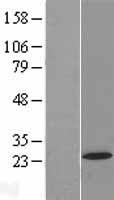 AP5S1 / C20orf29 Protein - Western validation with an anti-DDK antibody * L: Control HEK293 lysate R: Over-expression lysate