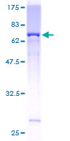 AP5Z1 Protein - 12.5% SDS-PAGE of human AP5Z1 stained with Coomassie Blue