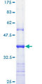 APAF1 / APAF-1 Protein - 12.5% SDS-PAGE Stained with Coomassie Blue.