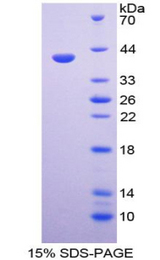 APAF1 / APAF-1 Protein - Recombinant Apoptotic Peptidase Activating Factor 1 By SDS-PAGE