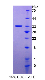 APBA2 Protein - Recombinant  Amyloid Beta Precursor Protein Binding Protein A2 By SDS-PAGE