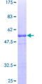 APBB1IP / RIAM Protein - 12.5% SDS-PAGE of human APBB1IP stained with Coomassie Blue