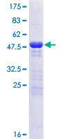 APBB1IP / RIAM Protein - 12.5% SDS-PAGE of human APBB1IP stained with Coomassie Blue