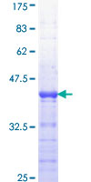 APC Protein - 12.5% SDS-PAGE Stained with Coomassie Blue.