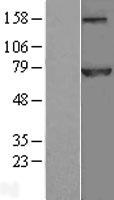 APC6 / CDC16 Protein - Western validation with an anti-DDK antibody * L: Control HEK293 lysate R: Over-expression lysate