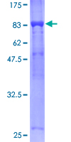 APC6 / CDC16 Protein - 12.5% SDS-PAGE of human CDC16 stained with Coomassie Blue