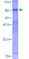 APC6 / CDC16 Protein - 12.5% SDS-PAGE of human CDC16 stained with Coomassie Blue