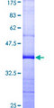 APC6 / CDC16 Protein - 12.5% SDS-PAGE Stained with Coomassie Blue.