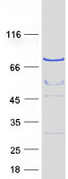 APC6 / CDC16 Protein - Purified recombinant protein CDC16 was analyzed by SDS-PAGE gel and Coomassie Blue Staining