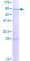 APCDD1 Protein - 12.5% SDS-PAGE of human APCDD1 stained with Coomassie Blue