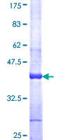 APCDD1 Protein - 12.5% SDS-PAGE Stained with Coomassie Blue