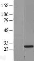 APCS / Serum Amyloid P / SAP Protein - Western validation with an anti-DDK antibody * L: Control HEK293 lysate R: Over-expression lysate