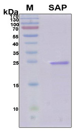 APCS / Serum Amyloid P / SAP Protein - SDS-PAGE under reducing conditions and visualized by Coomassie blue staining