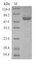 APCS / Serum Amyloid P / SAP Protein - (Tris-Glycine gel) Discontinuous SDS-PAGE (reduced) with 5% enrichment gel and 15% separation gel.