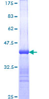 APCS / Serum Amyloid P / SAP Protein - 12.5% SDS-PAGE Stained with Coomassie Blue.