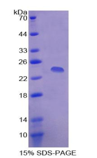 APCS / Serum Amyloid P / SAP Protein - Recombinant Serum Amyloid P Component By SDS-PAGE