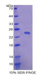 APCS / Serum Amyloid P / SAP Protein - Recombinant Serum Amyloid P Component By SDS-PAGE
