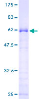 APEX1 / APE1 Protein - 12.5% SDS-PAGE of human APEX1 stained with Coomassie Blue