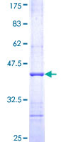 APEX1 / APE1 Protein - 12.5% SDS-PAGE Stained with Coomassie Blue.