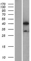 APG4B / ATG4B Protein - Western validation with an anti-DDK antibody * L: Control HEK293 lysate R: Over-expression lysate