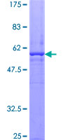 APG5 / ATG5 Protein - 12.5% SDS-PAGE of human ATG5 stained with Coomassie Blue