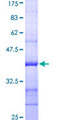 APG5 / ATG5 Protein - 12.5% SDS-PAGE Stained with Coomassie Blue.