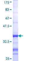 Apg7 / ATG7 Protein - 12.5% SDS-PAGE Stained with Coomassie Blue.