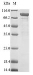 APH / APEH Protein - (Tris-Glycine gel) Discontinuous SDS-PAGE (reduced) with 5% enrichment gel and 15% separation gel.
