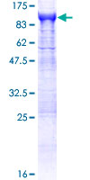 APH / APEH Protein - 12.5% SDS-PAGE of human APEH stained with Coomassie Blue