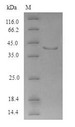 APH1A / APH-1 Protein - (Tris-Glycine gel) Discontinuous SDS-PAGE (reduced) with 5% enrichment gel and 15% separation gel.