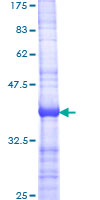 API5 Protein - 12.5% SDS-PAGE Stained with Coomassie Blue.