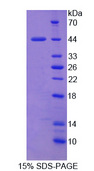 API5 Protein - Recombinant Apoptosis Inhibitor 5 By SDS-PAGE