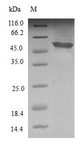 APIP Protein - (Tris-Glycine gel) Discontinuous SDS-PAGE (reduced) with 5% enrichment gel and 15% separation gel.