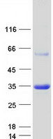 APIP Protein - Purified recombinant protein APIP was analyzed by SDS-PAGE gel and Coomassie Blue Staining