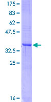 APLP1 / APLP-1 Protein - 12.5% SDS-PAGE Stained with Coomassie Blue.