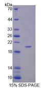 APLP1 / APLP-1 Protein - Recombinant  Amyloid Beta Precursor Like Protein 1 By SDS-PAGE