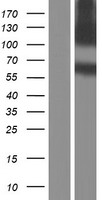 APLP2 Protein - Western validation with an anti-DDK antibody * L: Control HEK293 lysate R: Over-expression lysate